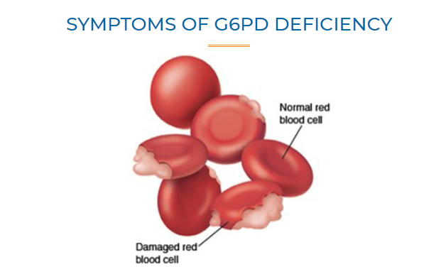 Men G6PD là một loại men giúp cho các tế bào hồng cầu hoạt động bình thường